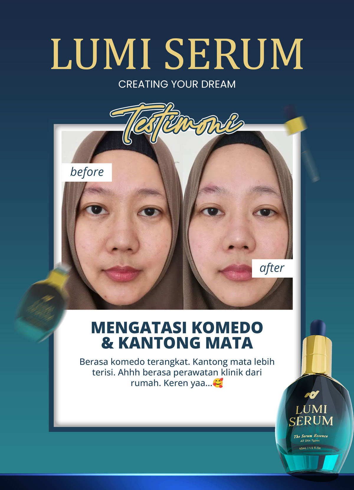 testi